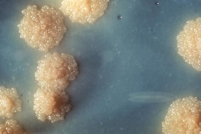 Mycobacterium tuberculosis culture revealing this organism’s colonial morphology.source