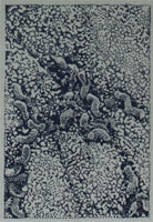 Scanning electron micrograph of H. pylori.source