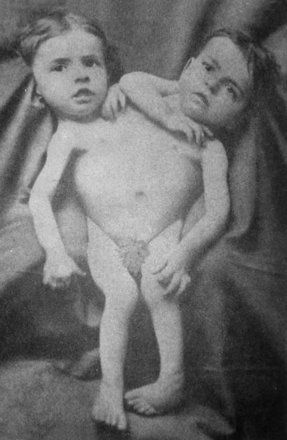 The Tocci twins in 1881