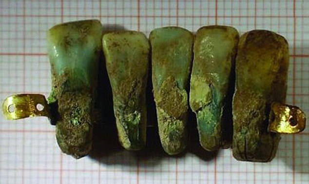 Dentures were uncovered during a dig in Lucca Photo Credit