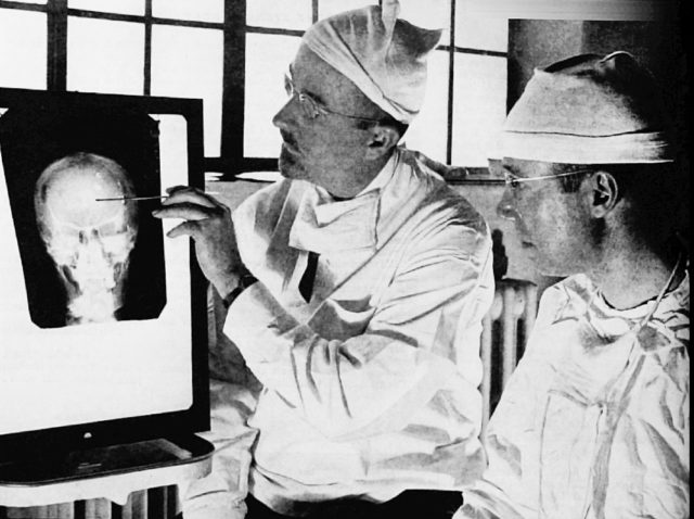 Dr. Walter Freeman, left, and Dr. James W. Watts study an X ray before an operation.
