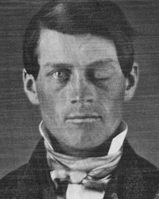 Phineas Gage Cased Daguerreotype Photo:Jack and Beverly Wilgus CC BY-SA 3.0