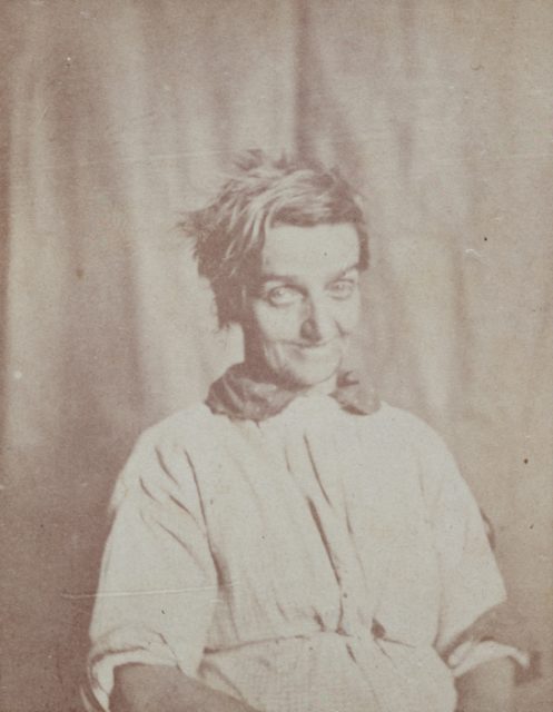 Patient of Surrey County Lunatic Asylum (H.W. Diamond)