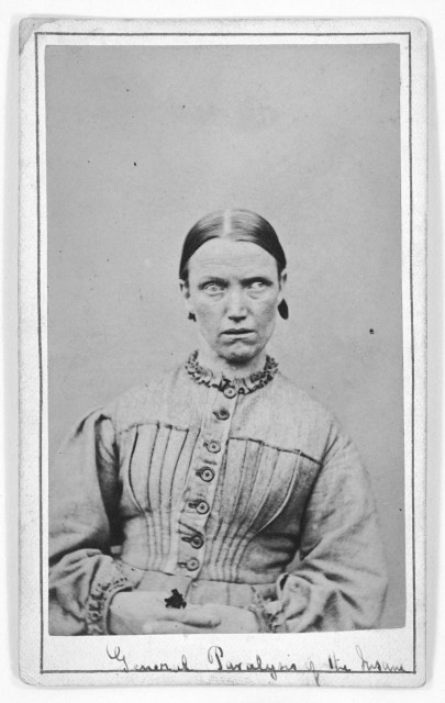  Woman suffering from general paralysis; c. 1869 Credit: Wellcome Library, London. Wellcome Images 