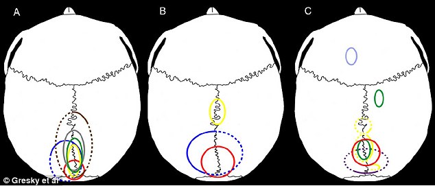 They all have holes or marks on their skulls in the same place – the middle of the back of the head Source:Gresky Et Al