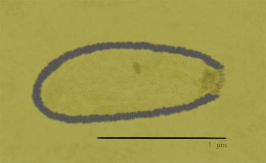 Pithovirus sibericum virus Source:By Pavel Hrdlička, Wikipedia, CC BY-SA 3.0, 