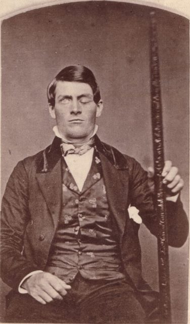 Phineas Gage and rod that injured him