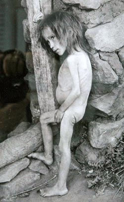 Starving Russian girl in Buguruslan, 1921