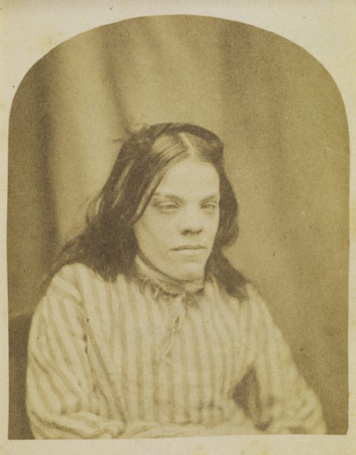 Patient, Surrey County Lunatic Asylum (H.W. Diamond)