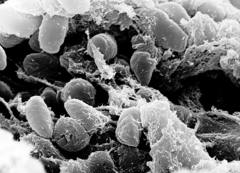 Credit:Ê Rocky Mountain Laboratories, NIAID, NIH Scanning electron micrograph depicting a mass of Yersinia pestis bacteria (the cause of bubonic plague) in the foregut of the flea vector
