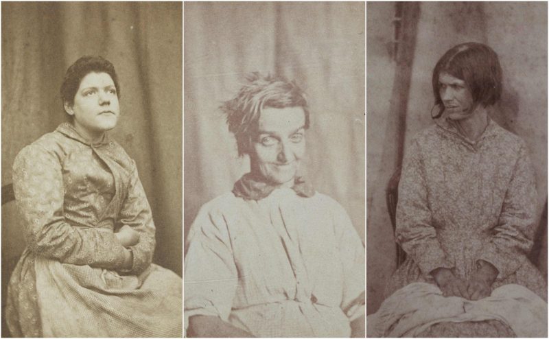 Photos of female asylum patients by a Victorian ...
 Insane Asylum Patients Photos