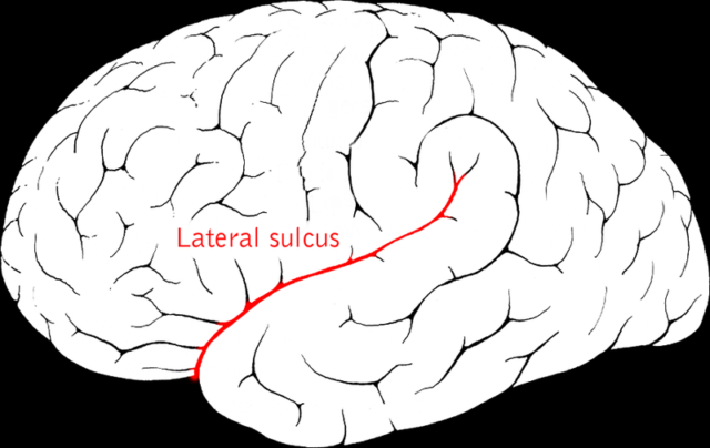 The lateral sulcus (Sylvian fissure) in a normal brain. In Einstein’s brain, this was truncated. Photo by Jimhutchins CC BY-SA 3.0