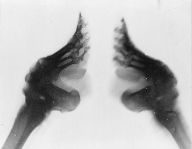 An X-ray of two bound feet.