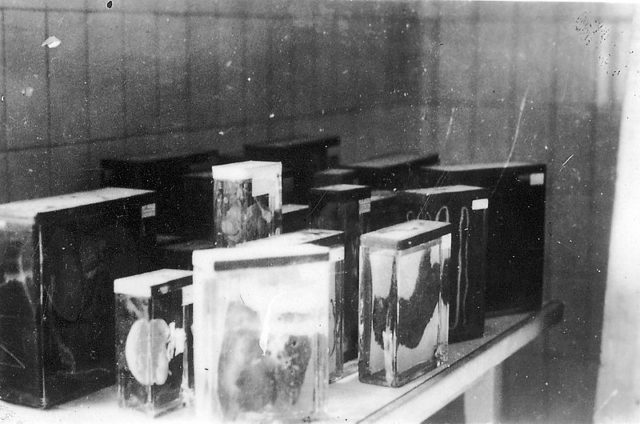 Buchenwald 16 de abril de 1945. Una colección de órganos internos de prisioneros Photo Credit