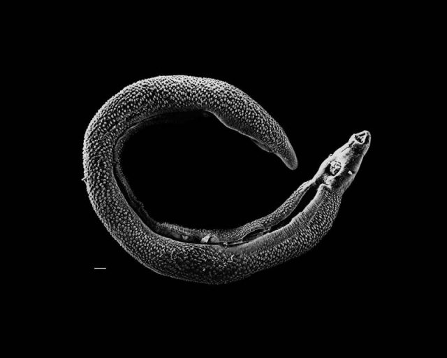 Electron micrograph of an adult male Schistosoma parasite worm. The bar (bottom left) represents a length of 500μm (0.02 inches).