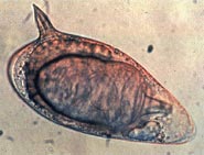 Schistosoma mansoni egg.