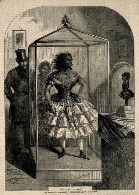 Julia Pastrana, a bearded lady, embalmed. Wood engraving. Photo by Wellcome Images CC BY 4.0