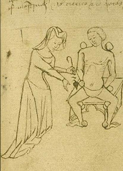 Illustration of an examination during an impotence trial.