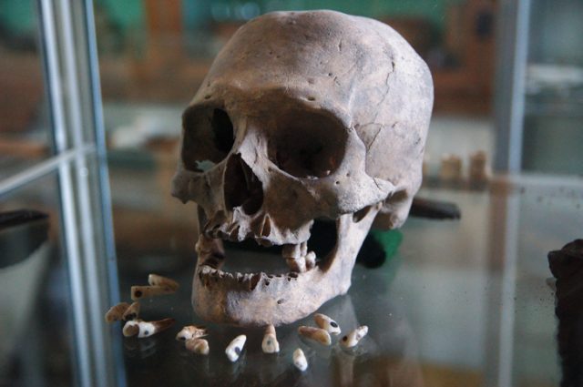 Old Mayan Skull and Teeth in Guatemala