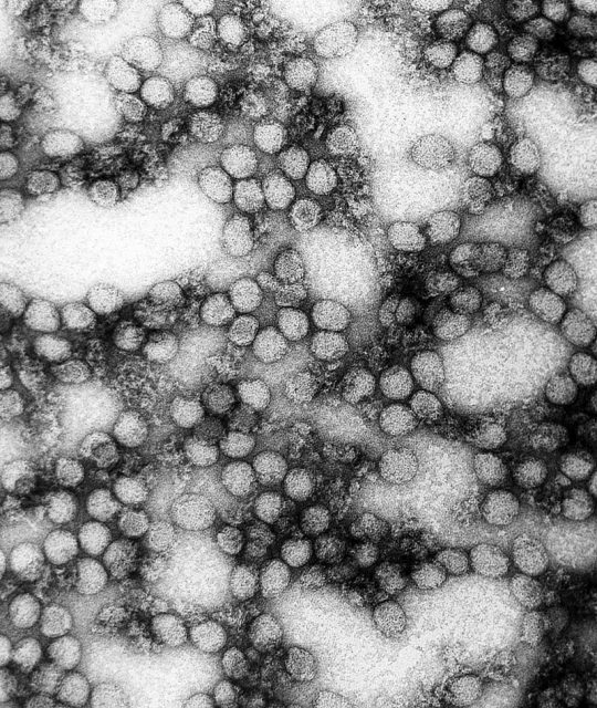 A TEM micrograph of yellow fever virus (234,000× magnification)