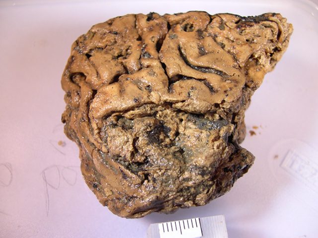 Heslington brain