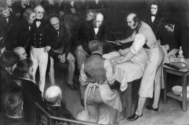 Robert Liston operating. The artist was Ernest Board of Bristol (1877-1934), and this was one of the paintings he was commissioned to paint by Henry S. Wellcome