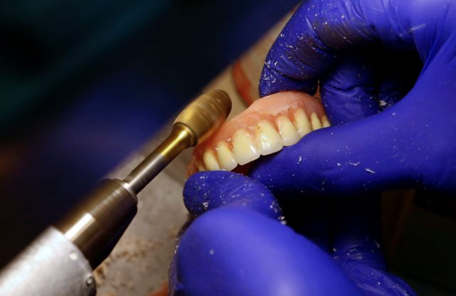 Dr. Walter Tickner grinds and polishes new dentures 