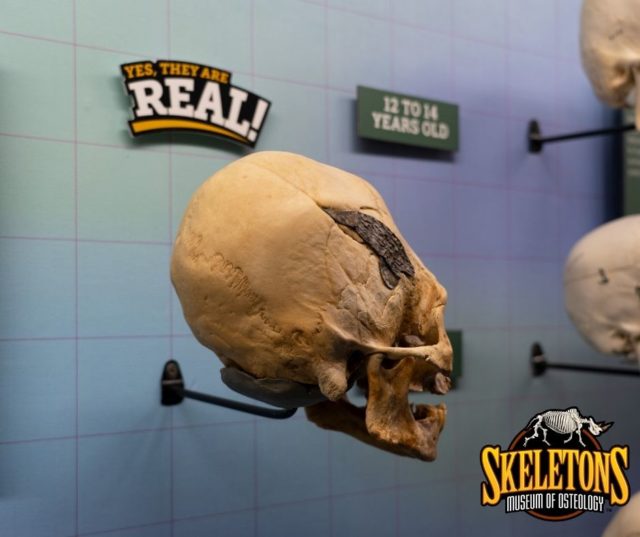 Skull of Peruvian warrior 