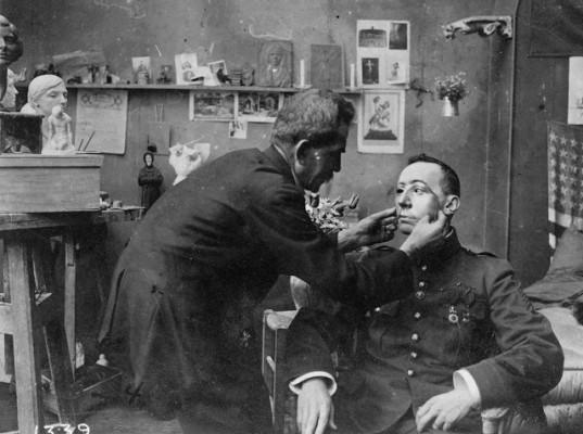 French soldier whose face was mutilated in World War I, being fitted with a mask made at the American Red Cross studio of Anna Coleman Ladd. (Library of Congress)
