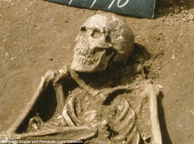 Historic documents and analysis of 27 skeletons buried at Columbus' settlement in what is now the Dominican Republic suggests the early colonisers suffered from severe scurvy 