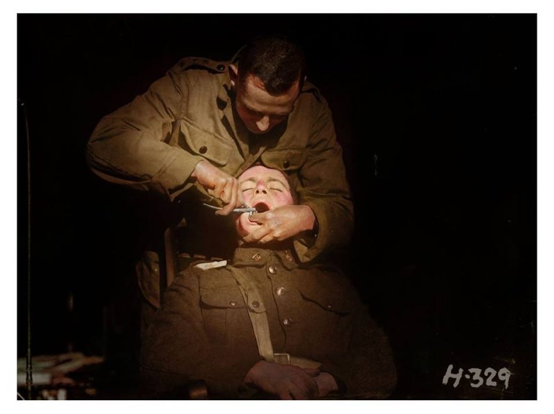 A New Zealand soldier undergoing a dental extraction at the New Zealand Dental Corps hospital in Nielles-lès-Bléquin, France, during the First World War. November 1917. In the early stages of the war, between a quarter to a third of recruits were rejected for service on account of dental defects. The New Zealand Dental Association, seeing an opportunity to raise their profile, took up the challenge to treat these men and contribute to the war effort. They lobbied the Defence Force to create the first ever Dental Corps in November 1915, with the aim to have every soldier of the Expeditionary Force dentally fit for service. This was by no means an easy feat. Dental officers inspected the teeth of prospective soldiers in New Zealand mobilisation camps, and accompanied troops when they were mobilised overseas. If the Army’s policy was to send a reinforcement of approximately two thousand healthy men each month, the work of the New Zealand Dental Corps (NZDC) was not to be underestimated. Between 1915 and 1918, they performed 221,214 filling operations and 98,817 teeth extractions. The NZDC earned a reputation for mobility and efficiency. A dental hospital was set up only 5 kilometres from the front line on the Somme in September 1916. From ‘moral tooth brush drills’ at the camps to fillings, extractions and the treatment of the prevalent gum disease, ‘trench mouth’, the Dental Corps is thought to have saved the State around £19,000 per year. Photograph taken by Henry Armytage Sanders. Image courtesy of Alexander Turnbull Library, reference: 1/4-009512-G. (Colourised by Richard James Molloy from the UK)