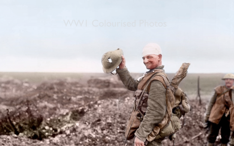 A wounded British soldier showing the shrapnel damage to his steel helmet caused near Beaumont-Hamel, on the Somme Front in December 1916. (© IWM Q 1778) (Colourised by Doug UK)