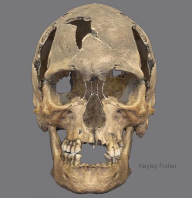 The 600-year-old skull was broken when it was first discovered .Source: The City Of Edinburgh Council.Source :Hayley Fisher