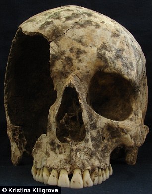 This skull of a 35-50 year old of a man who was originaly from the Alps