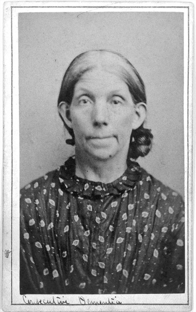 L0019061 'Consecutive dementia' patient at West Riding Lunatic Asylum Credit: Wellcome Library, London. Wellcome Images images@wellcome.ac.uk http://wellcomeimages.org 'Consecutive dementia' female patient at West Riding Lunatic Asylum, Wakefield, York. Photograph circa 1869 By: Henry ClarkePublished: - Copyrighted work available under Creative Commons Attribution only licence CC BY 4.0 http://creativecommons.org/licenses/by/4.0/
