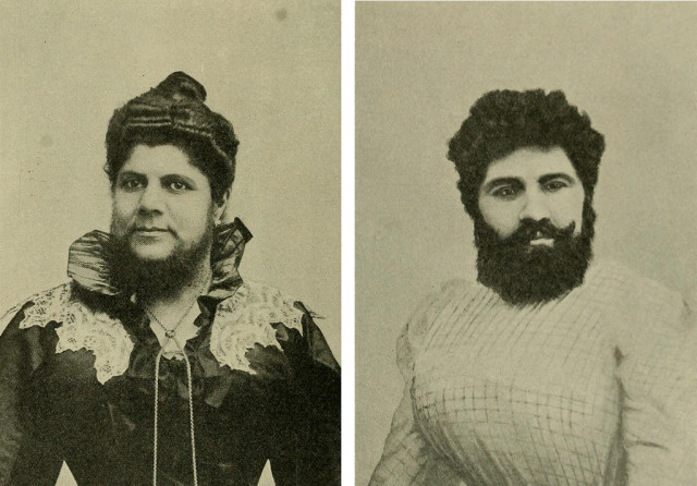 Frau Josephine Budra and Anna HUdjos, two hemaphrodites featured in Hermaphroditismus beim Menschen (1908). source