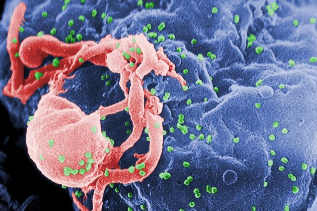 Scanning electron micrograph of HIV-1, colored green, budding from a cultured lymphocyte.