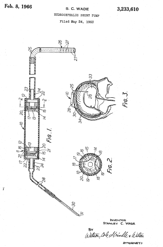 Illustration of valve, from patent application