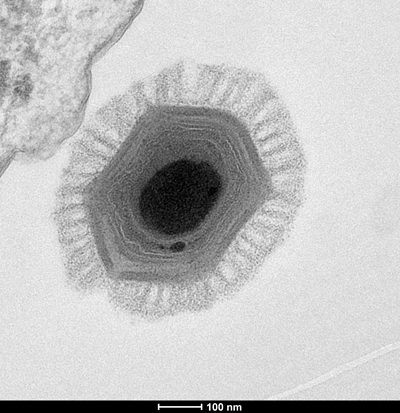 Megavirus particle Source:By Chantal Abergel - Own work, CC BY-SA 3.0, 