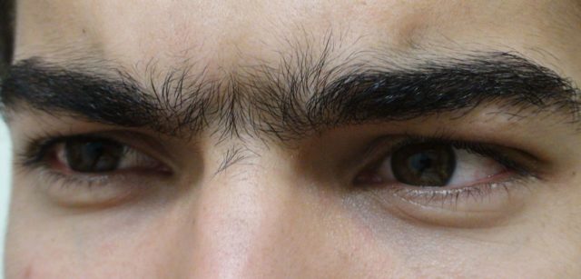 A close up of the human unibrow. Photo Credit
