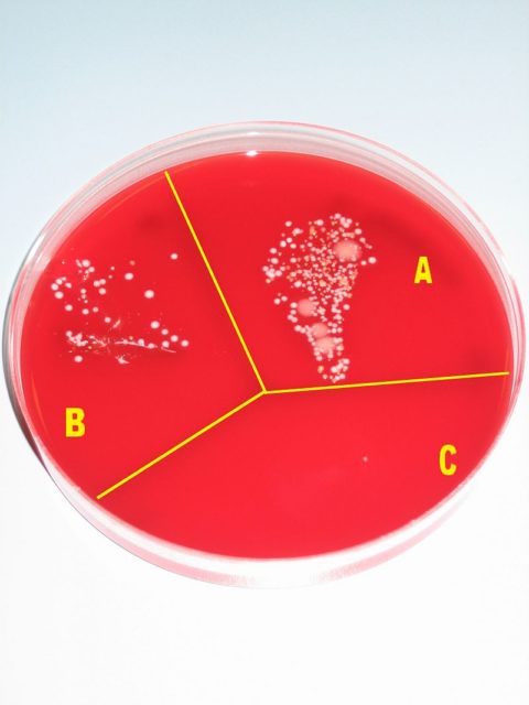 Microbial cultures demonstrating the effectiveness of disinfection — without disinfection procedures (A), after washing hands with soap (B) and after disinfection with alcohol (C). Photo credit