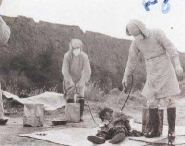 Unknown experiment conducted on a victim in at the Unit 731 complex
