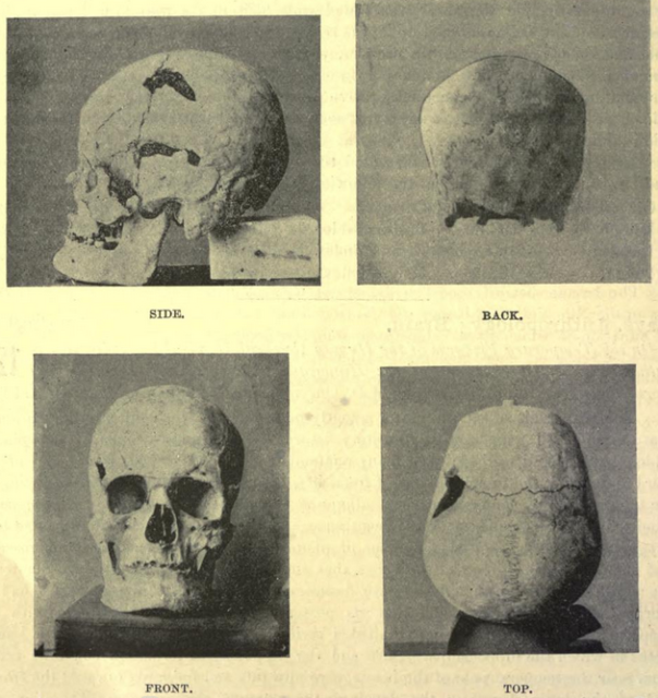 Possible skull of Pharaoh Sanakht from mastaba K2 at Beit Khallaf.
