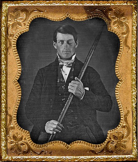 Phineas Gage. Photo:Jack and Beverly Wilgus CC BY-SA 3.0