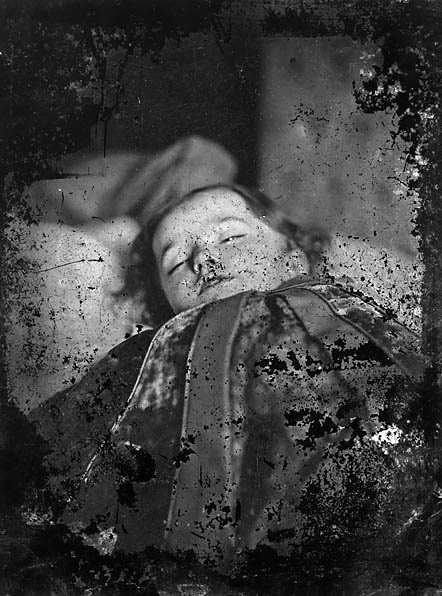 Postmortem photograph of a deceased child.