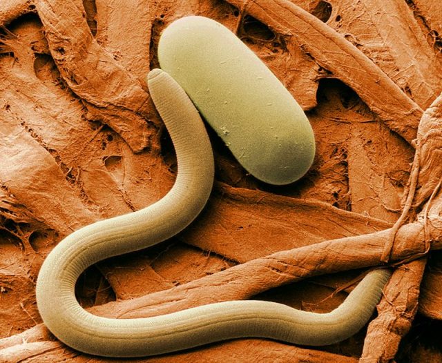 Colorized electron micrograph of soybean cyst nematode (Heterodera) and egg.
