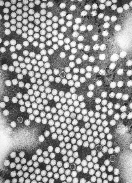 A TEM micrograph of poliovirus.
