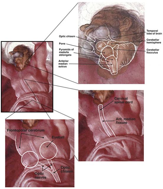 Suk and Tamargo proposed that there are three concealed neuroanatomical images in the Separation of Light from Darkness, the first panel in the Genesis series. photo by Nus1937 CC BY-SA 3.0