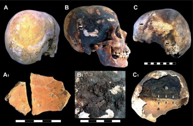 Red and black mineral incrustations detected in the victims’ skulls. Photo by Petrone et al/Plos Journal