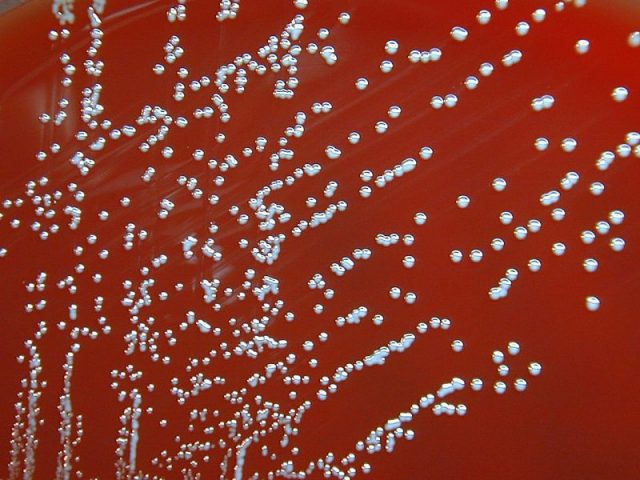 Brucella melitensis colonies growing on agar.